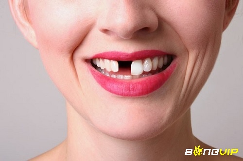 Giấc mơ thấy răng rụng nhưng không chảy máu thể hiện cho những mất mát nhỏ mà bạn có thể gánh chịu