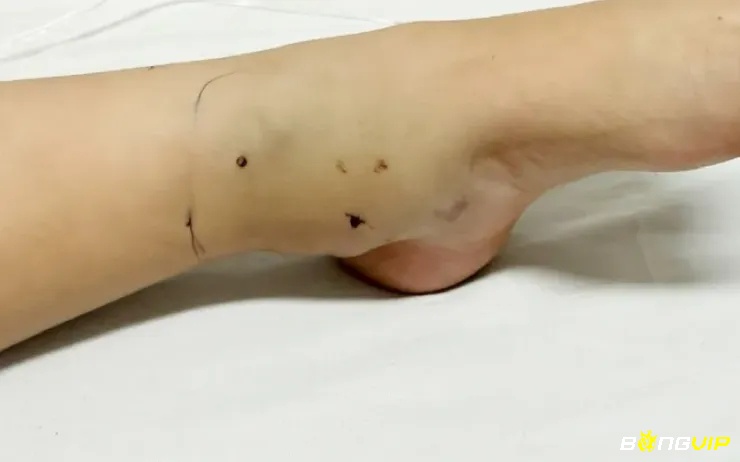 Giấc mơ thấy rắn cắn vào chân thể hiện cho những trở ngại khiến các kế kế hoạch của bạn bị chậm lại